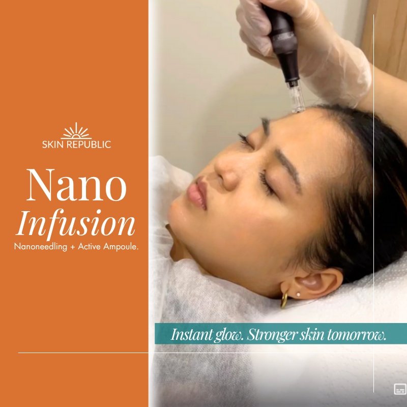 Beyond Microneedling: The Science of “Skin Training” Through Skin Republic’s Nano Infusion